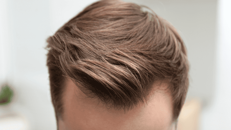 greffe de cheveux dangers